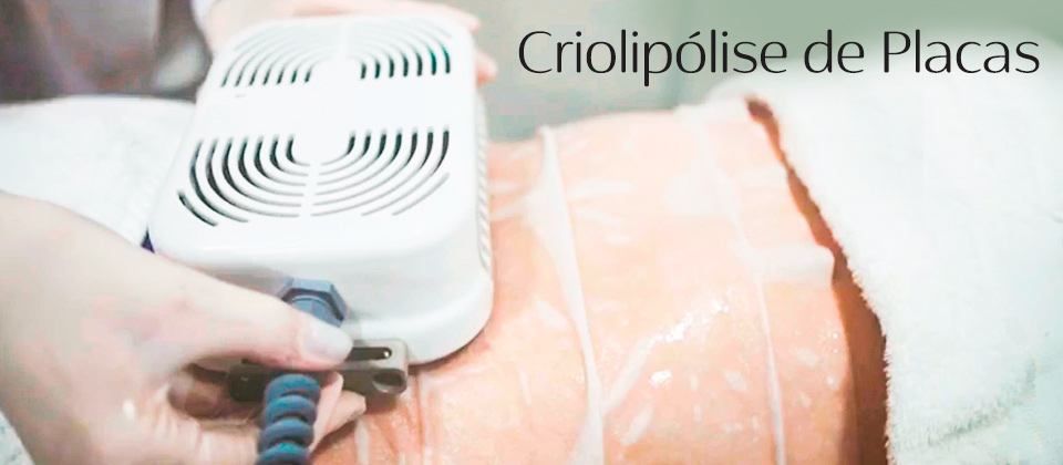 Tratamento Corporal Criolipolise em Placas Estética Modelle